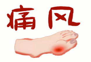 為什么男性更容易痛風(fēng)